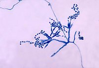 200px-Penicillium CDC.jpg