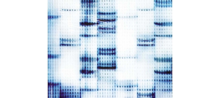 ElectrophoreticBands CEC2.jpg