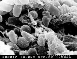 250px-Yersinia pestis Rocky Mountain Laboratories NIAID NIH.jpg