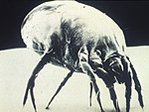 149px-NIH Dust Mite.jpg