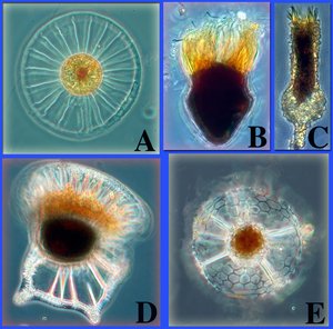 300px-Marine protists.jpg