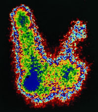 EE-Thyroid2 NIEHS.jpg