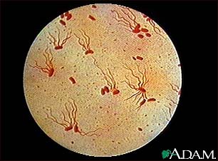 Salmonella typhi organism