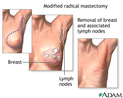 Procedure 2