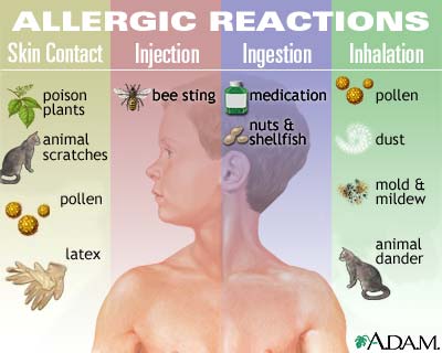 Allergic reactions