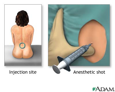 Procedure, part 3