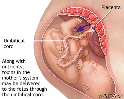 Substance abuse during pregnancy