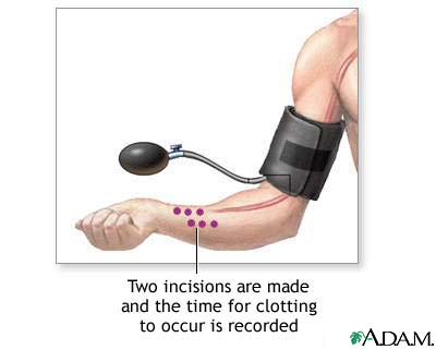 Blood clot test