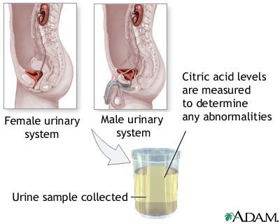 Citric acid urine test