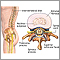 Intervertebral disk