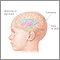 Intracranial pressure monitoring